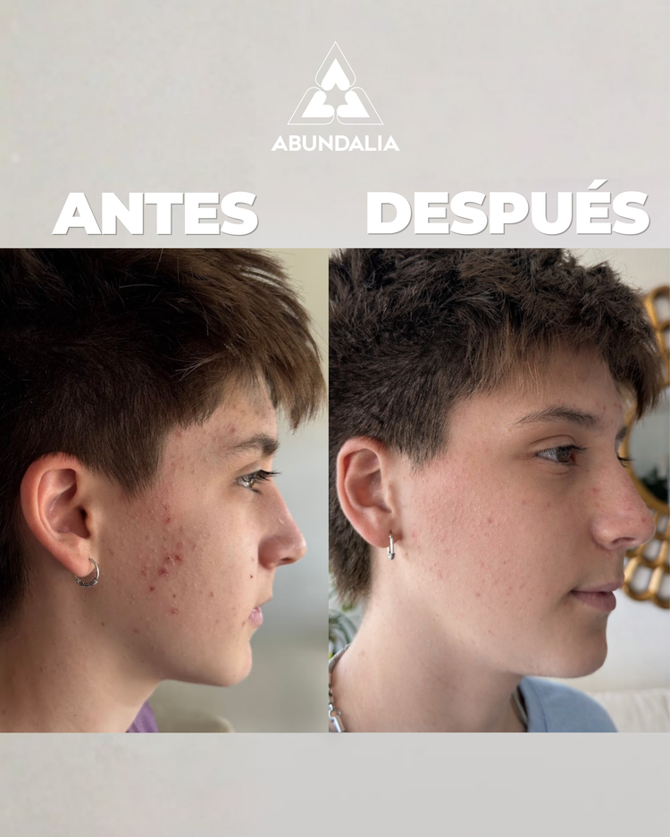 BRUMA FACIAL + 1 TRAVEL SIZE